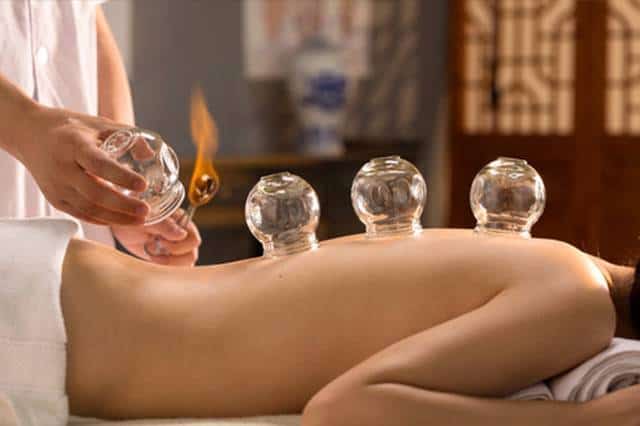 Cupping Therapy